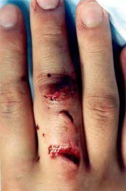 laceration-24.jpg